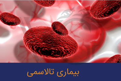موشن گراف تالاسمی